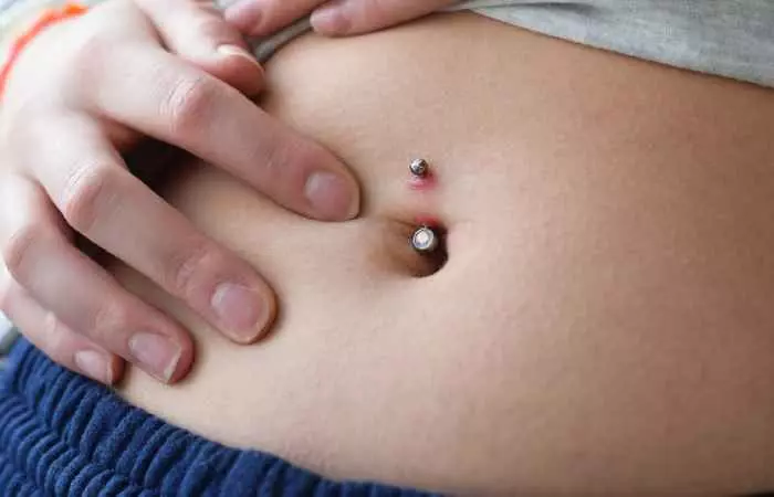  A woman checking her belly button piercing for signs of a keloid