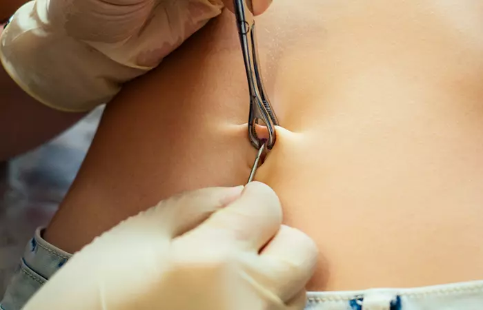 A woman getting a belly button piercing after her pregnancy