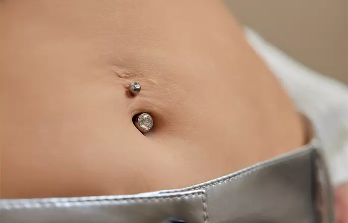 A woman with a belly button piercing scar after pregnancy