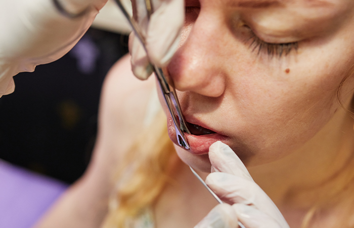 Woman getting her closed lip piercing checked