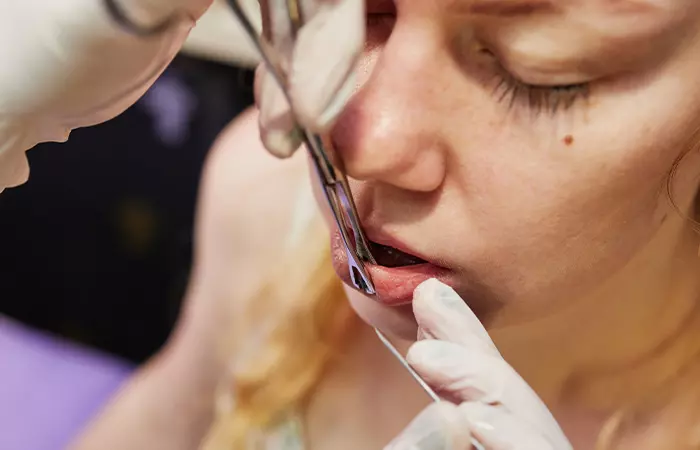 Woman getting her closed lip piercing checked