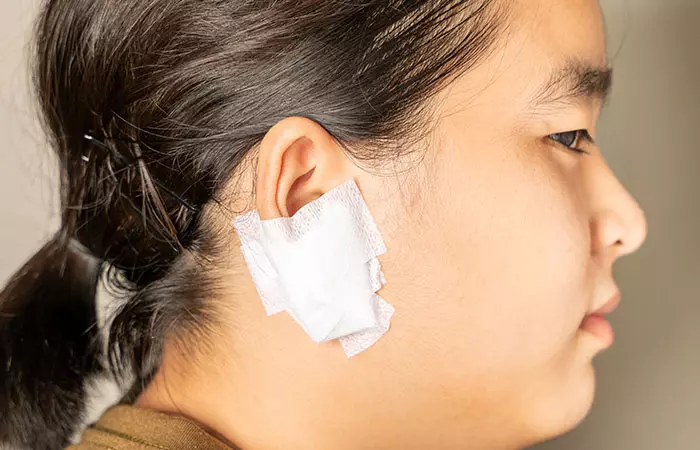 A woman with a bandage on an infected ear piercing