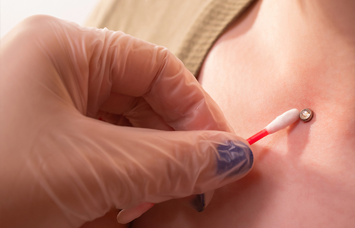 Cleaning the collarbone piercing with an earbud