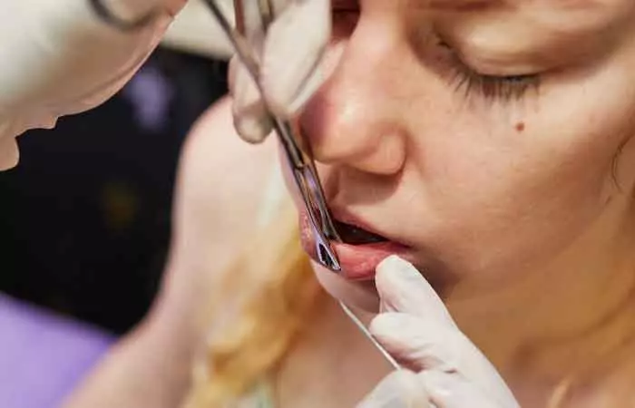 Woman getting her lips pierced