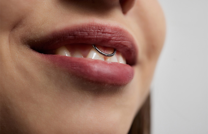 Smiley piercing