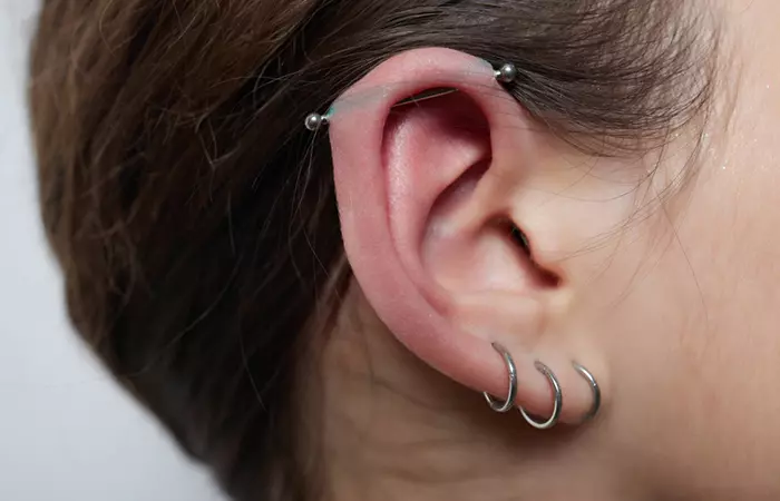 A woman with a swollen industrial piercing