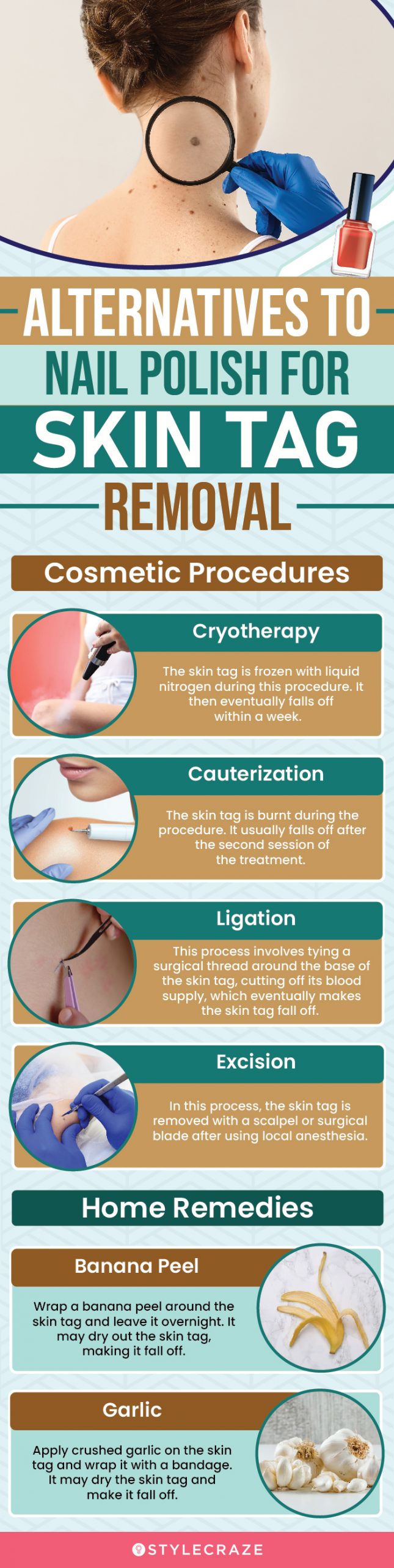 alternatives to nail polish for skin tag removal (infographic)
