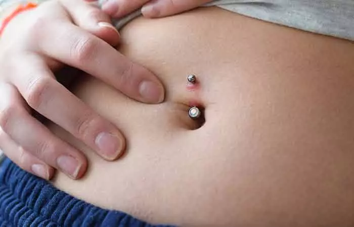 Close-up of an infected belly button piercing