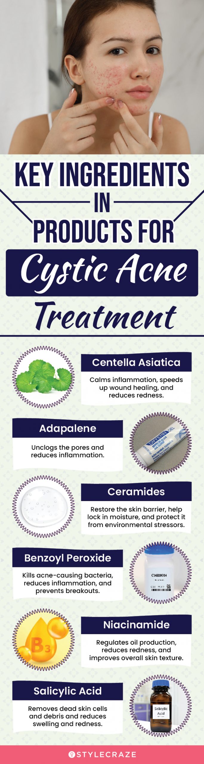 Key Ingredients In Products For Cystic Acne Treatment (infographic)
