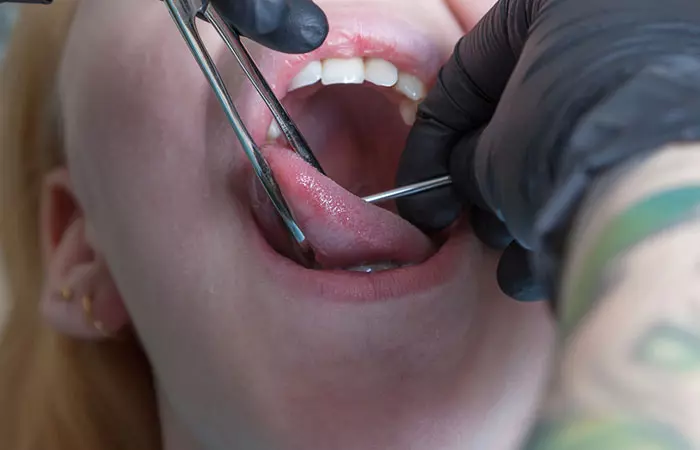 Woman getting her tongue pierced at a studio
