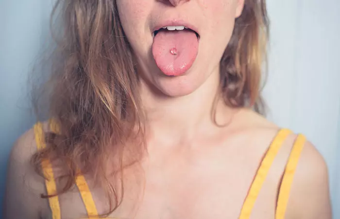 Woman with a healed tongue piercing