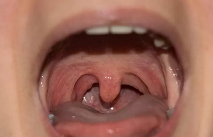 A woman showing her uvula where should would like to get pierced