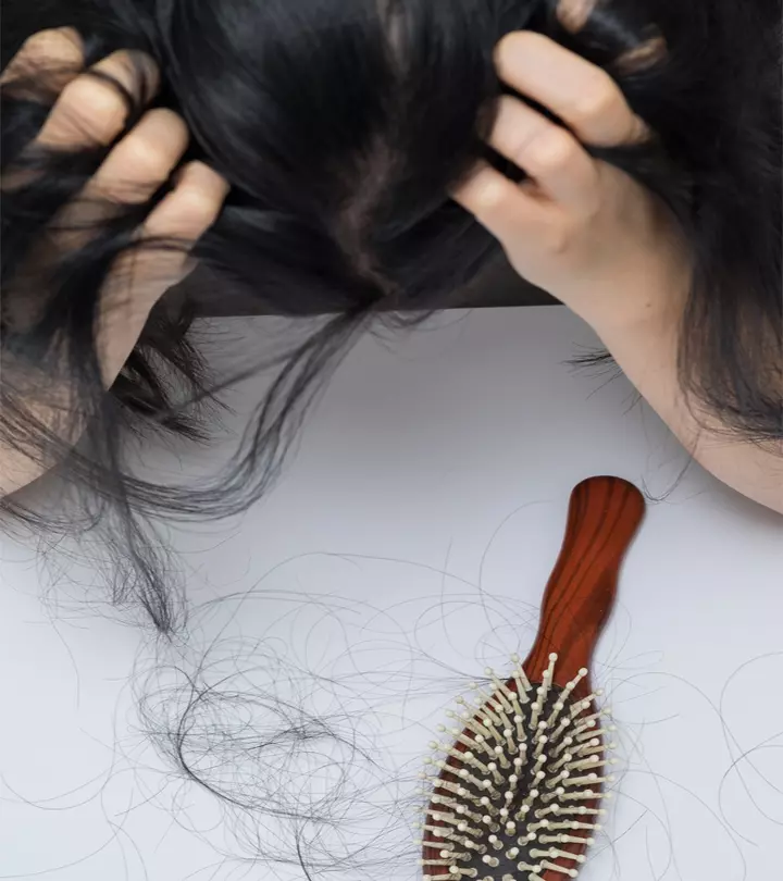 9 Ways To Know If Your Hair Loss Is Normal Or Something You Should Worry About?