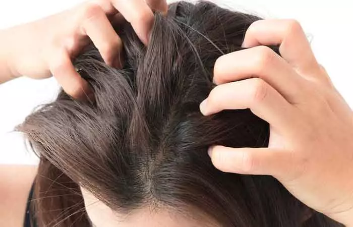 What-Causes-A-Dry-Scalp