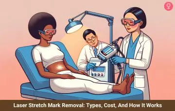 Laser Stretch Mark Removal: Types, Cost, And How It Works