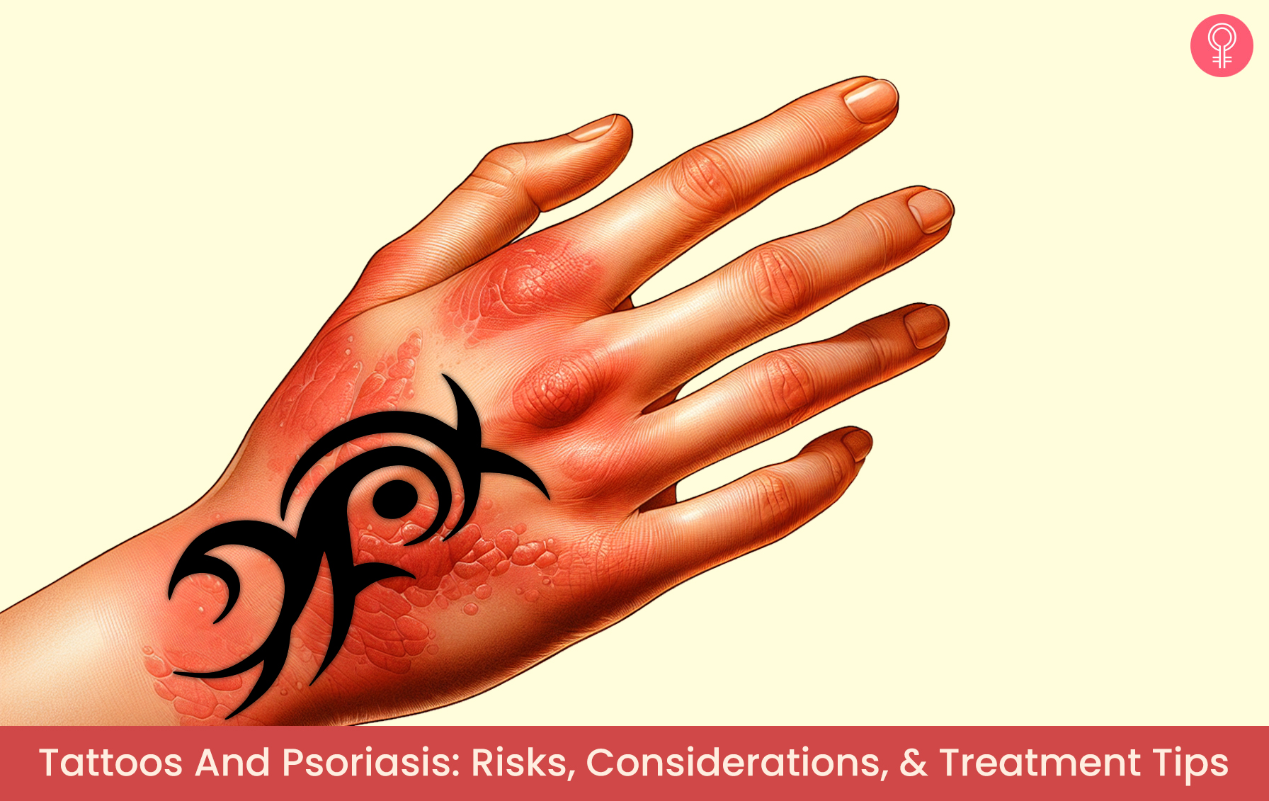 Tattoos And Psoriasis: Risks, Considerations, & Treatment Tips