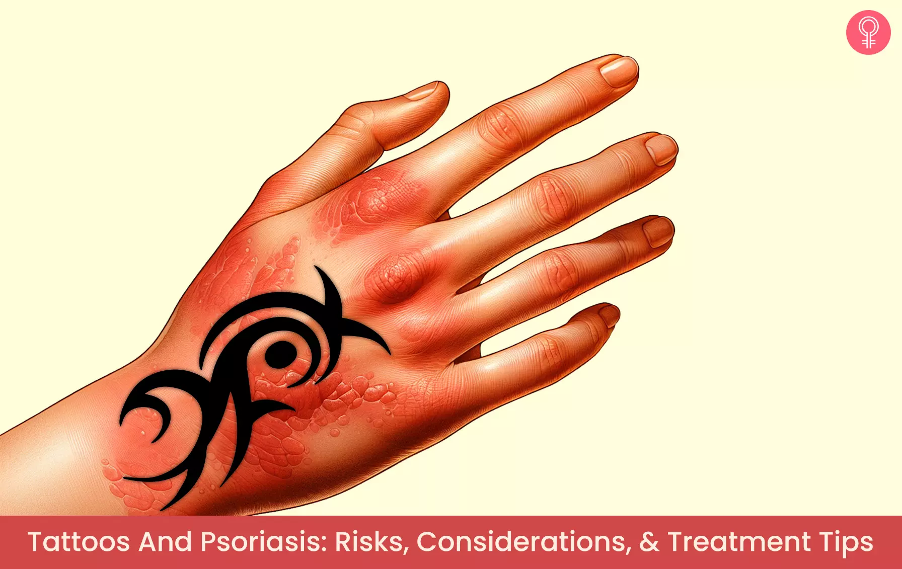 Tattoos And Psoriasis  Risks  Considerations    Treatment Tips - 64