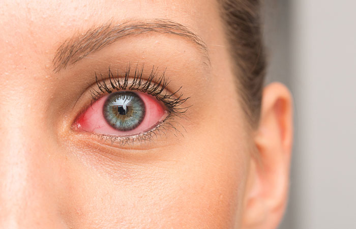 Castor oil may help reduce eye inflammation