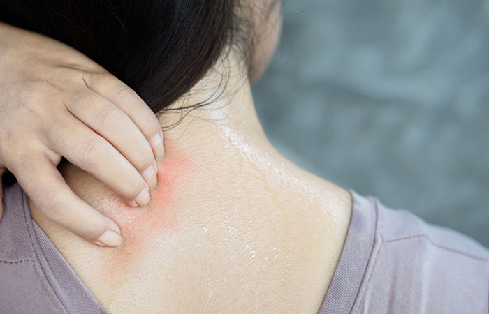 Red Spots On The Skin  Causes  Treatments   How To Get Rid Of Them - 58