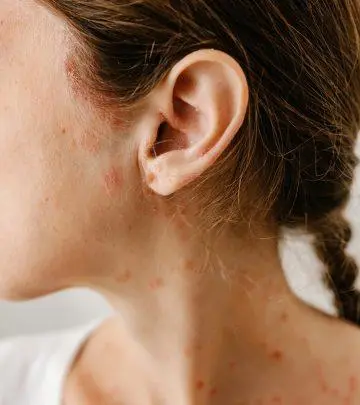 Woman with red spots on skin