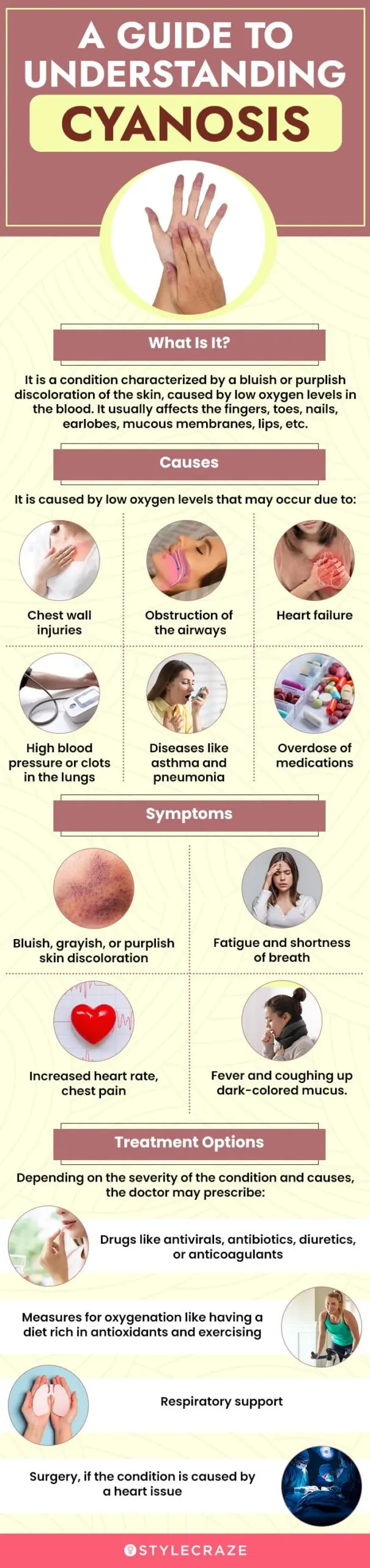 a-guide-to-understanding-cyanosis (infographic)