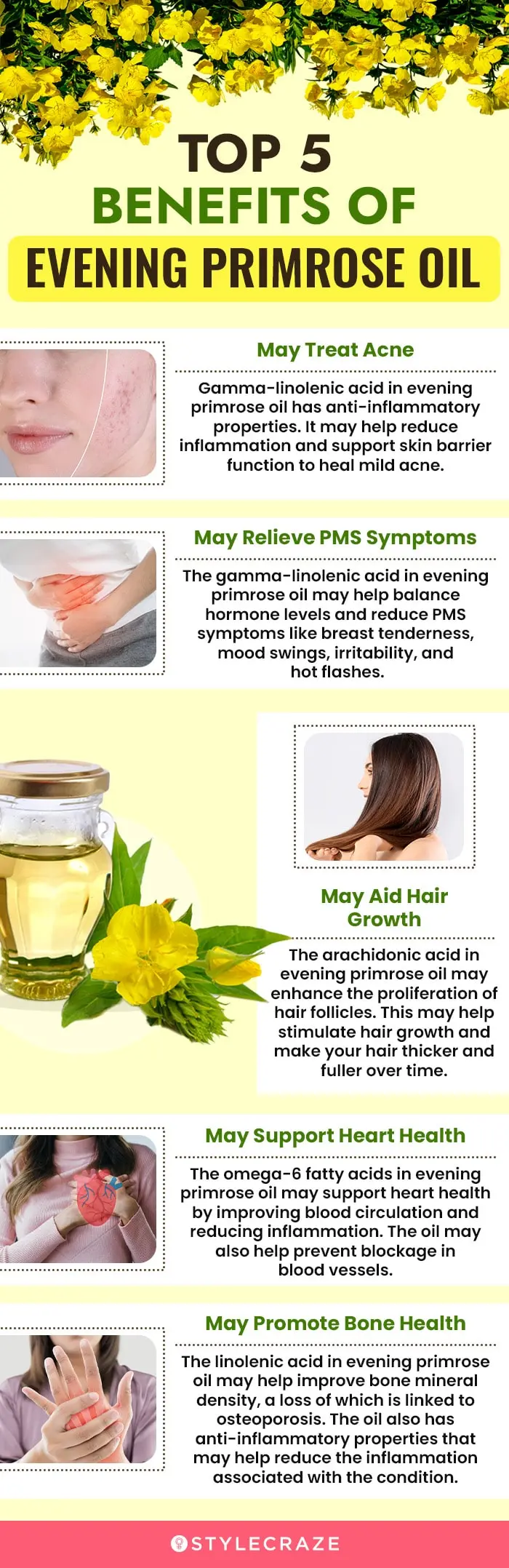 top-5-benefits-of-evening-primrose-oil (infographic)