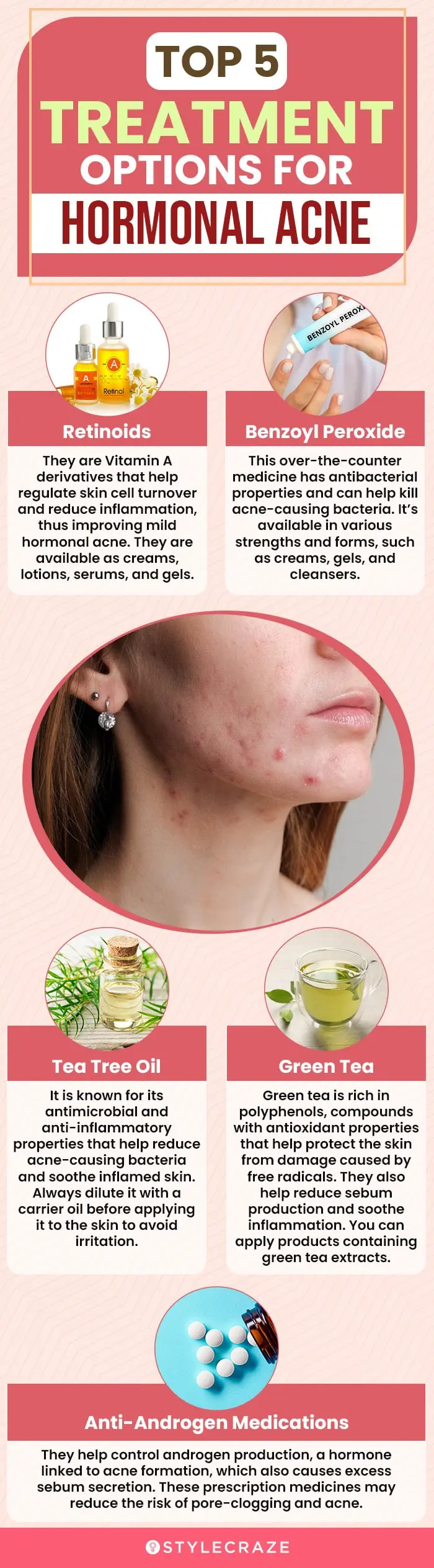 top-5-treatment-options-for-hormonal-acne (infographic)