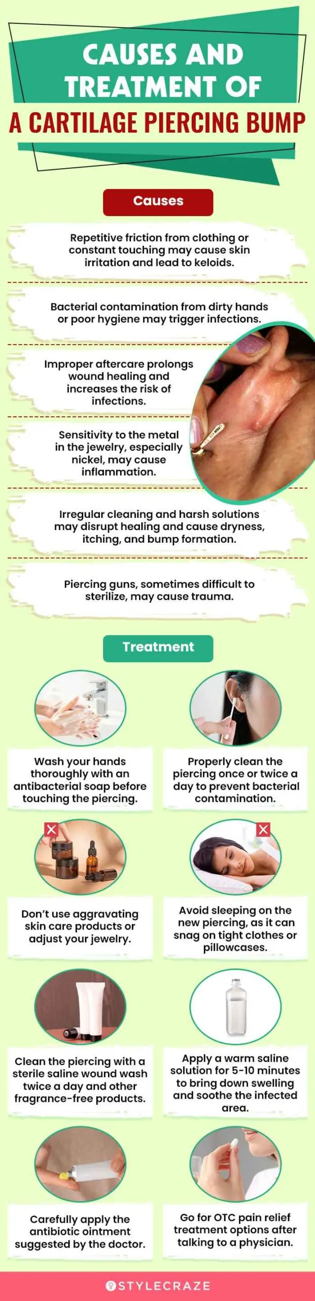 causes-and-treatment-of-a-cartilage-piercing-bump (infographic)