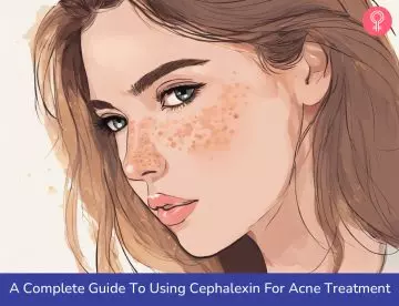 Cephalexin for acne
