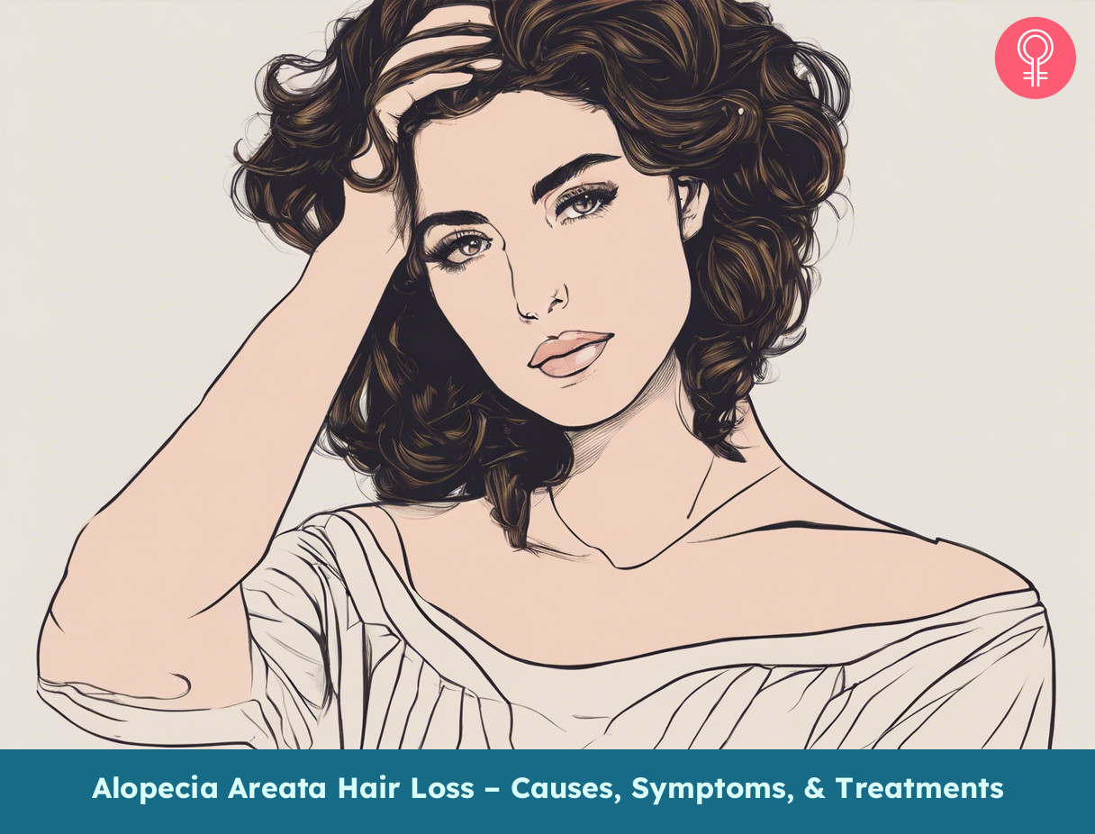 what is alopecia areata