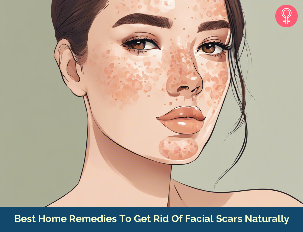 how to remove facial scars