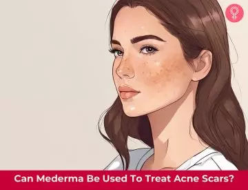 mederma for acne scars