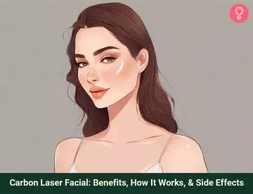 carbon laser facial