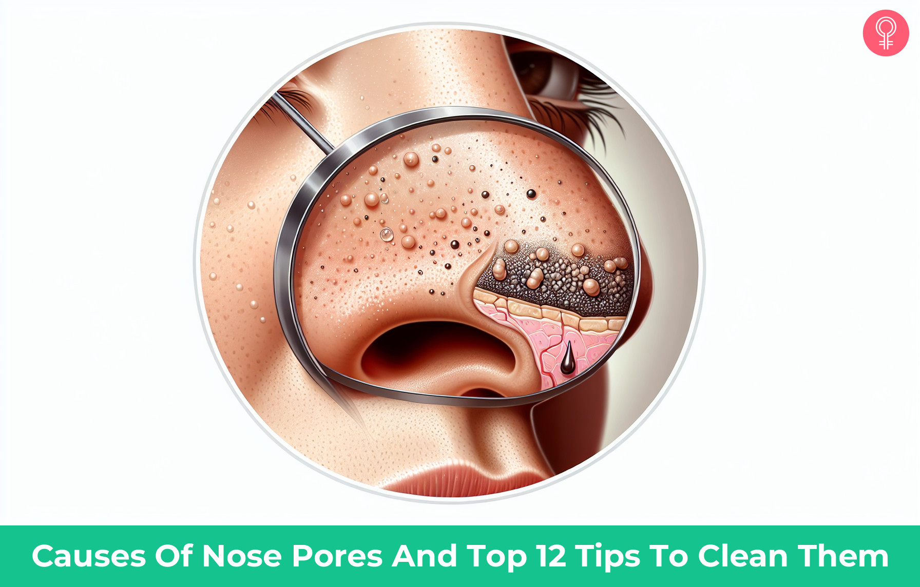 clogged pores on nose_illustration