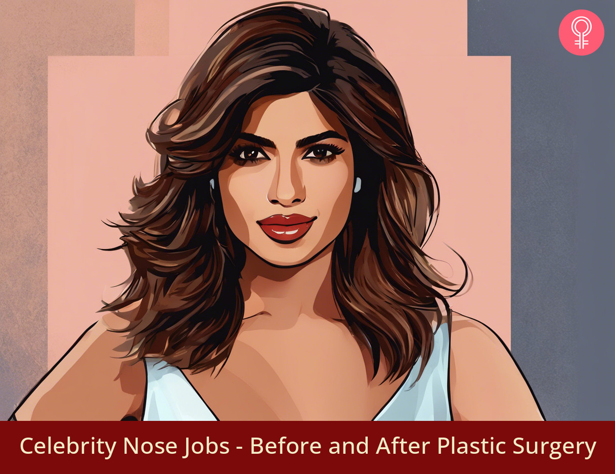 celebrity nose jobs
