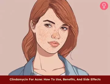 Clindamycin for acne