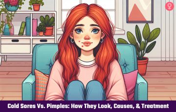 cold sore vs pimple