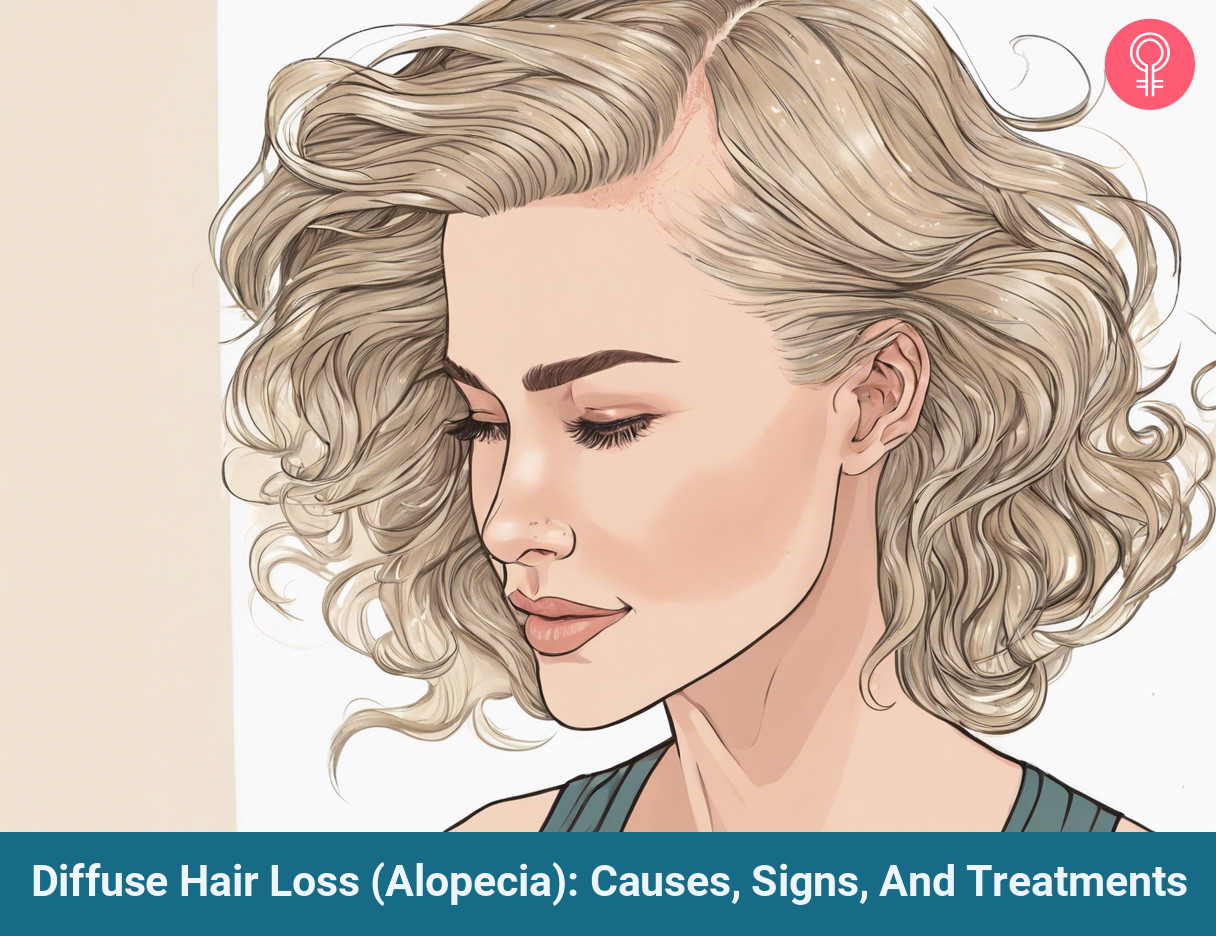 Diffuse hair loss