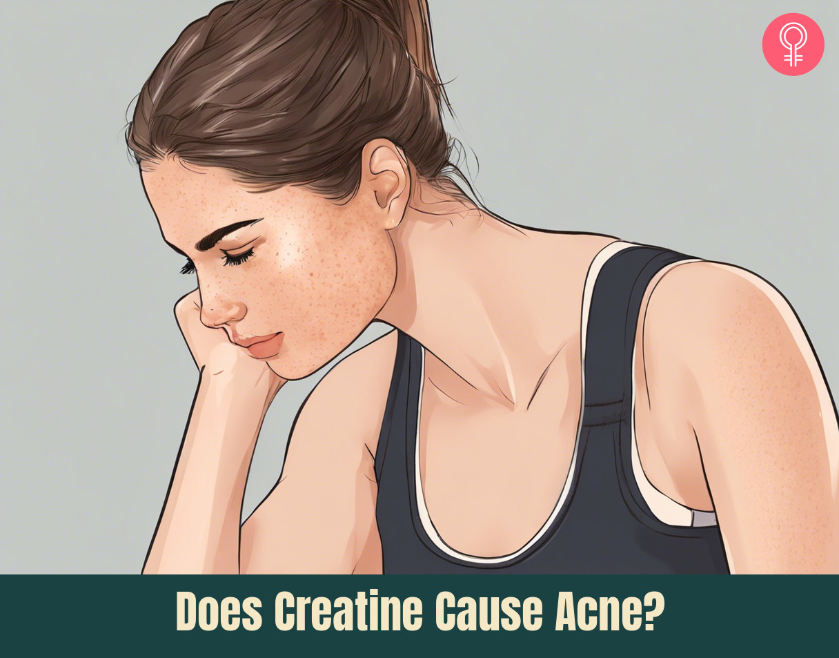 Creatine Cause Acne