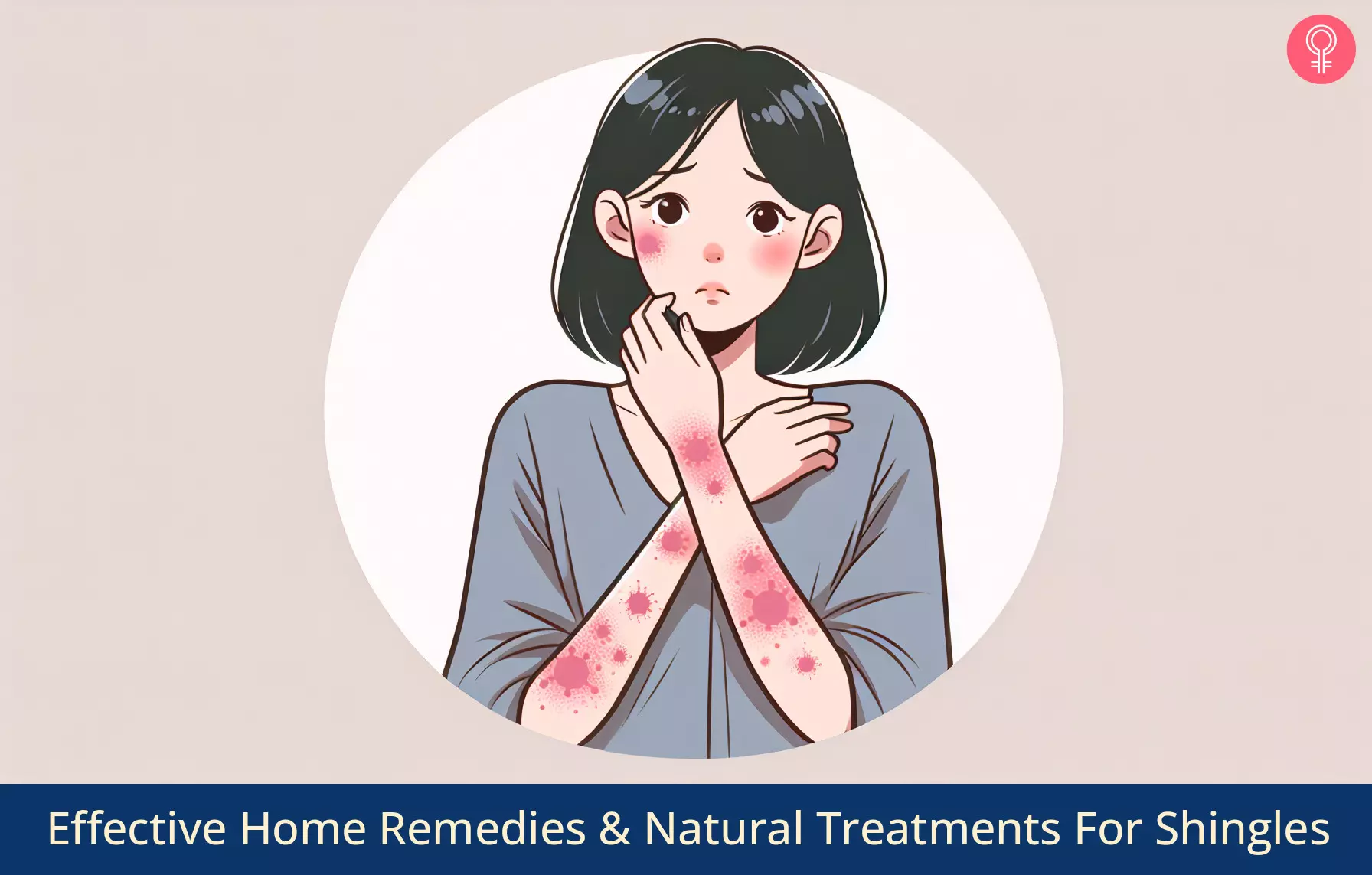 home remedies for shingles