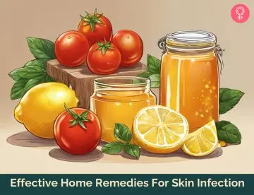 Home Remedies For Skin Infection