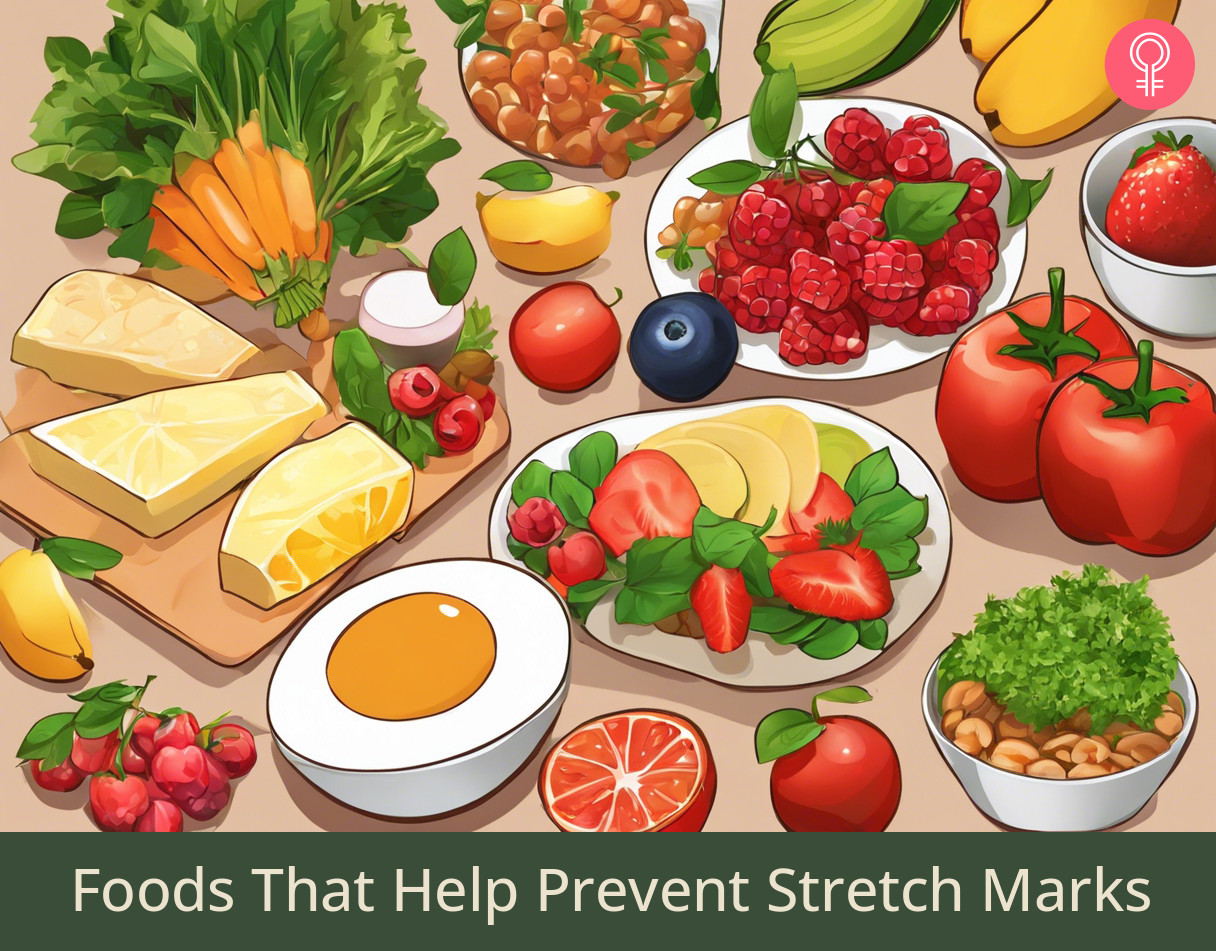 Best Foods For Stretch Marks