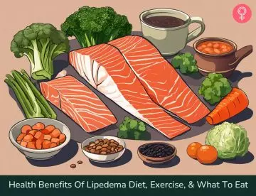 lipedema diet and exercise