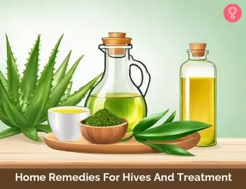 remedies for hives