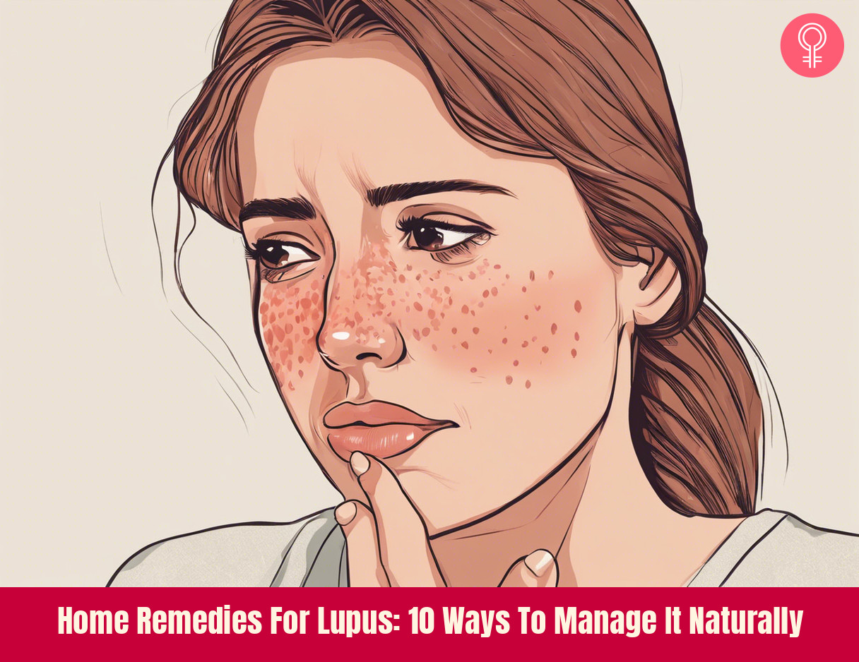 natural remedies for lupus