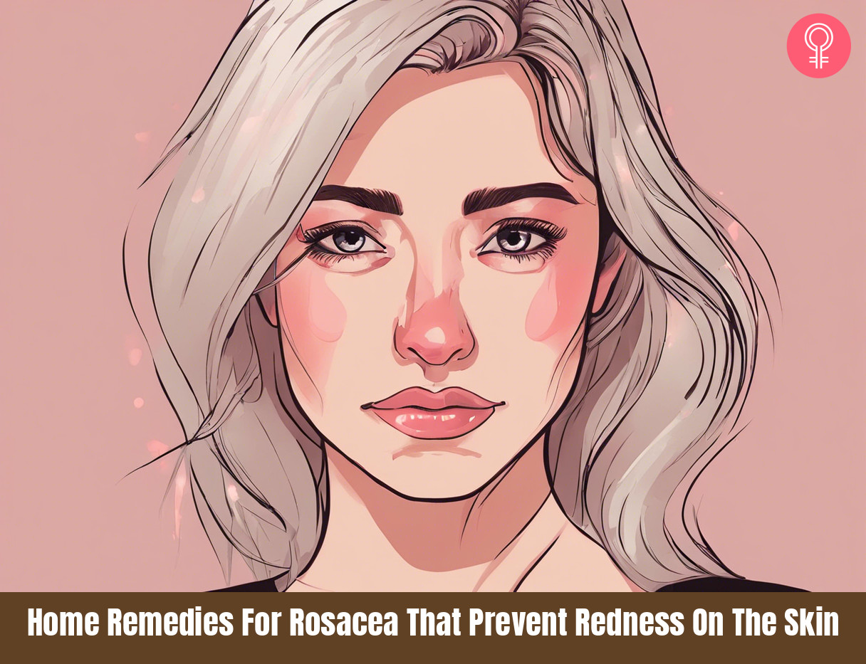 home remedies for rosacea
