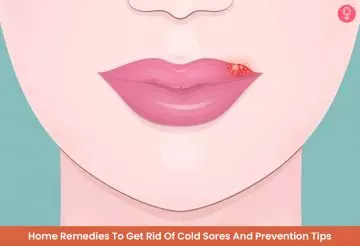 20 Home Remedies To Get Rid Of Cold Sores And Prevention Tips