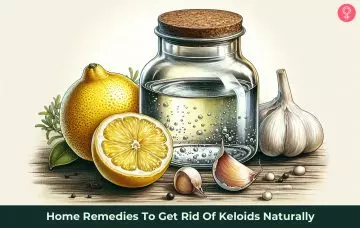 how to get rid of keloids