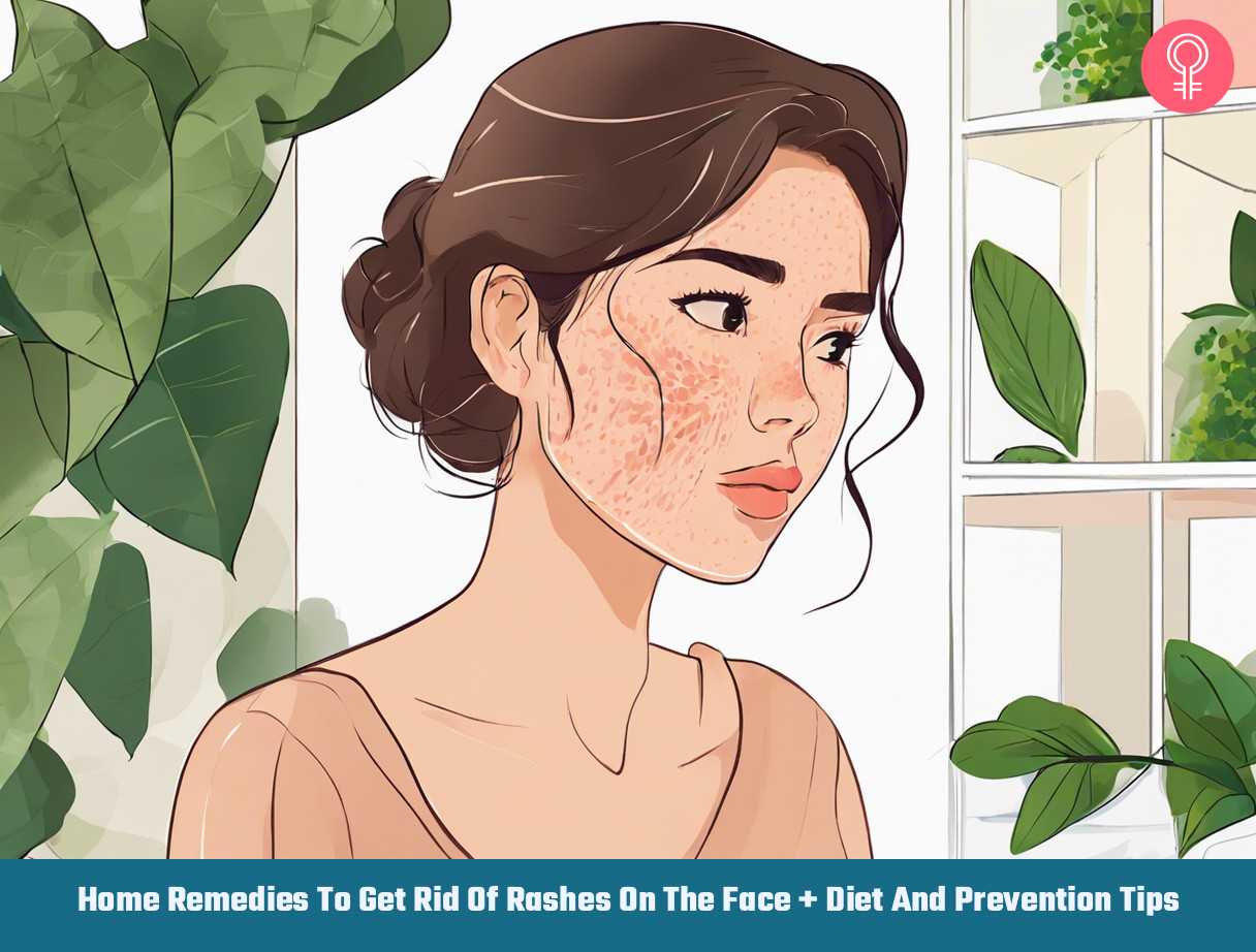 get rid of rashes on the face