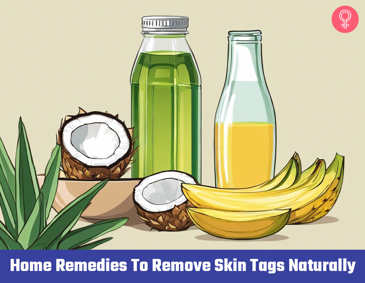 home remedies for skin tags